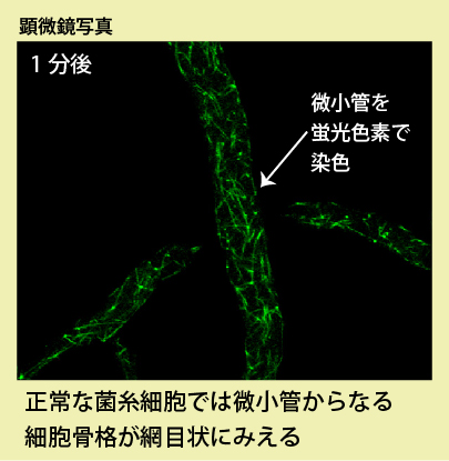 顕微鏡写真